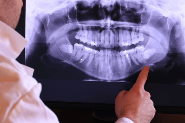 Best Emergency Root Canal Treatment in Annapolis, MD