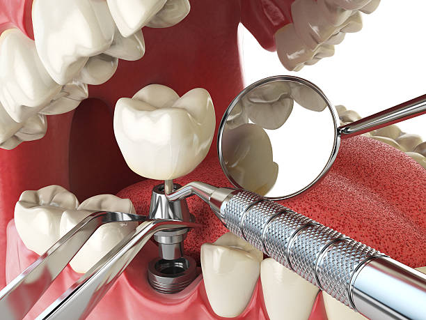 Best Holiday Emergency Dentist in Annapolis, MD